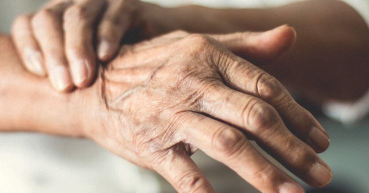 A blood test for Parkinson’s offers hope for early&nbsp;diagnosis.